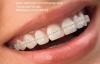 Foto de Ortodoncia Avanzada, Dentist Especialistas Dentales