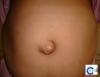 Foto de Hernia clinic-mdicos cirujanos