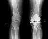 Foto de Dr. Allan Jair Ortega Morales - Traumatolog�a y Ortopedia